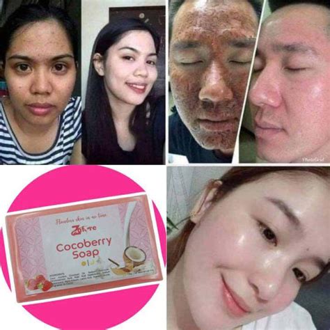 sabon na pampaputi|4 Skin Care Tips Na Pwede Mong Subukan Habang Nagbubuntis!.